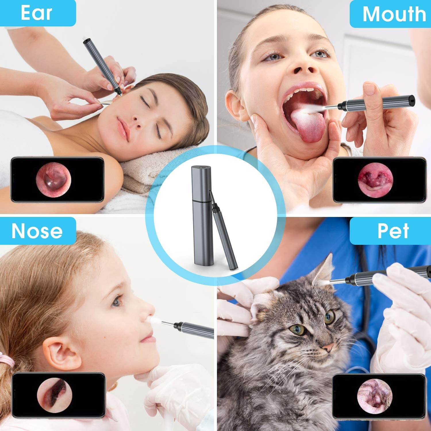 VITCOCO Ear Wax Removal, 1920P HD Wireless Otoscope Earwax Removal