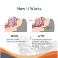 thumbnail image 2 of Mouth Guard Stop Snoring Devices, Anti Snoring Devices, Effective Snoring Solution Night Guard for Grinding Teeth,Snore Guard, 2 of 5