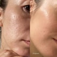 thumbnail image 3 of Exfoliante The Ordinary Acido Glycolico 100 ml, 3 of 5