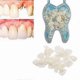 thumbnail image 2 of temporary dentures, 2 of 4