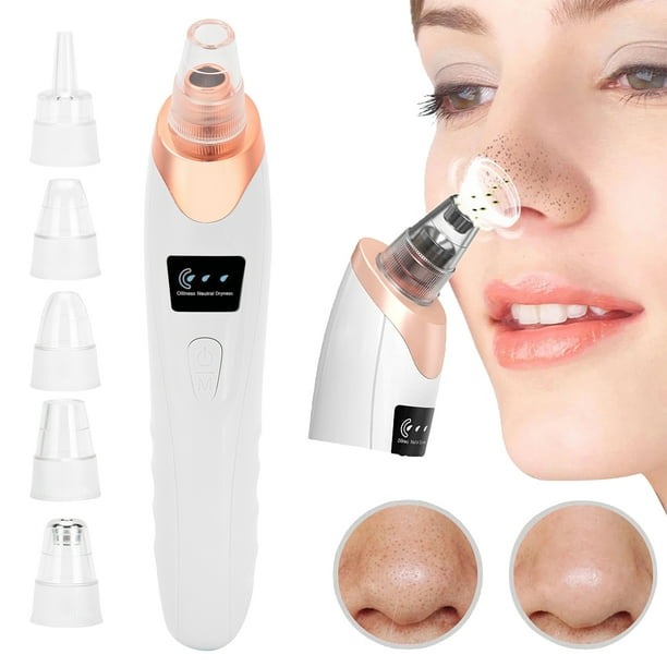 Blackhead removal online near me