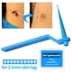 thumbnail image 5 of Kit De Eliminación De Etiquetas De Piel Herramienta Profesional De Eliminación De Verrugas De Etiquetas De Piel Con Anillo De Goma Para El Área De La Cara Y El Cuerpo 2-5 Mm Guardurnaity CE002429-00, 5 of 6