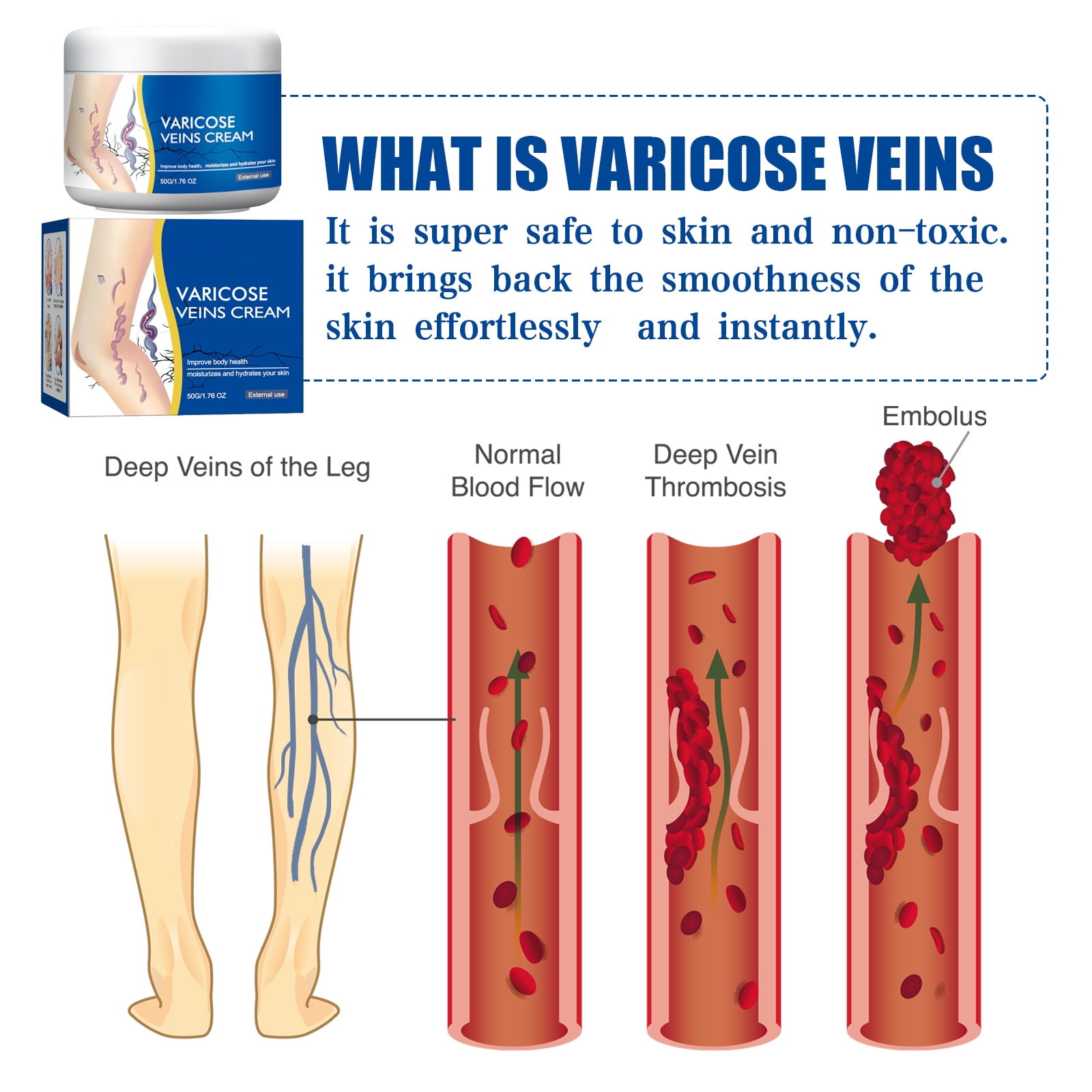 Alvantor Varicose Cream Soothing Vein Relief Leg Cream for Tired Legs 1.76oz