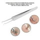 thumbnail image 5 of Extractor de granos de grasa, imperfecciones y puntos negros de acero inoxidable curvo, herramienta para el cuidado facial., 5 of 14
