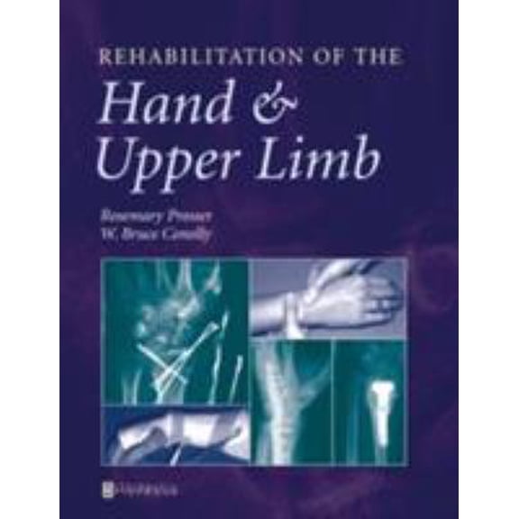Pre-Owned Rehabilitation of the Hand and Upper Limb (Paperback) 0750622636 9780750622639