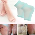 thumbnail image 4 of 1 Set Gel Heel Socks Woolen Toeless Comfortable Open Toe Silicone Beauty Hosiery Spa Experience Adjustable Kit for Summer Night Mesh Mint, 4 of 9