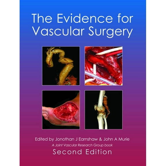 The Evidence for Vascular Surgery; second edition Dr John A Murie MA BSc MD FRCS (Hardcover)