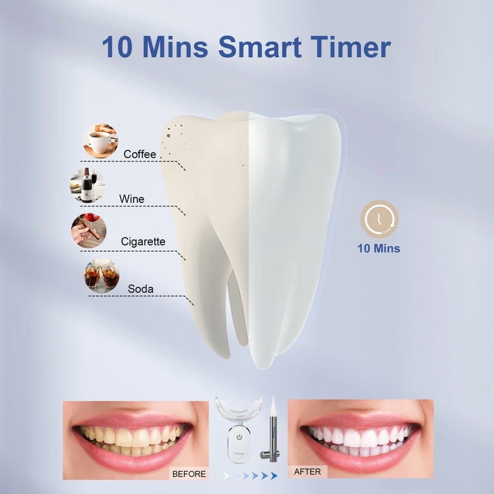 MySmile Deluxe Teeth Whitening Kit with Pens photo 8