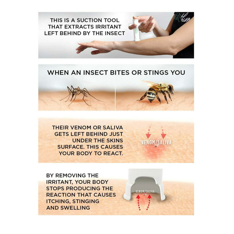 Bug Bite Thing Suction Tool, Poison Remover - Bug Bites and Bee/Wasp  Stings, Natural Insect Bite Relief- White/2 Pack 