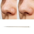 thumbnail image 5 of Unique Bargains Convenient Fine Facial Pimple Extractor 1 Pc Gold Tone, 5 of 6