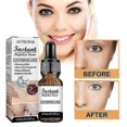 thumbnail image 5 of Jaysuing Face Serum Moisturizing Repair Skin Whiten Anti-aging Anti-wrinkle Deep Skincare Acne, 5 of 5