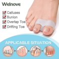 thumbnail image 3 of Pack Of 12 Bunion Corrector, Toe Separators With 2 Loops, Big Toe Spacer Suitable For Bunion And Overlap Toe (white), 3 of 5