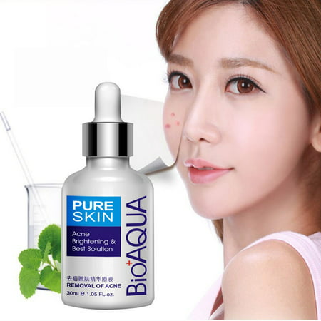 Face Care Acne Spots Acne Scar Removal Cream Skin Care Acne Treatment Whitening Moisturizing Essential Oil