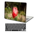 thumbnail image 3 of KSK KAISHEK Only for Newest MacBook Pro 13 inchs Case 2016 - 2022 Rel. Model A1706/A1708/A1989/A2159/A2251/A2289/A2338 M1, Plastic Hard Shell Cover + Black Keyboard Cover, Rose series 0969, 3 of 5