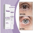 thumbnail image 4 of Crema para Ojos Glows Eyes con Colágeno 20 G | Reduce Arrugas, Ojeras, Bolsas y Párpados Caídos | Hidratante | Fórmula Antiedad, 4 of 7