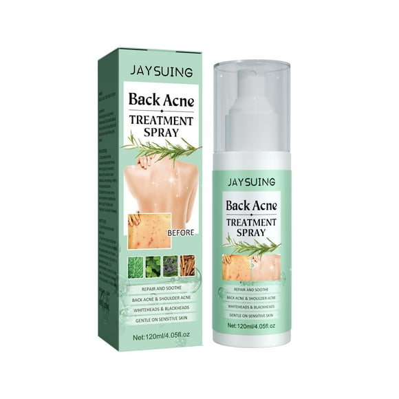 Back Acne Treatment Spray - Fast-Acting Spray for Acne Relief