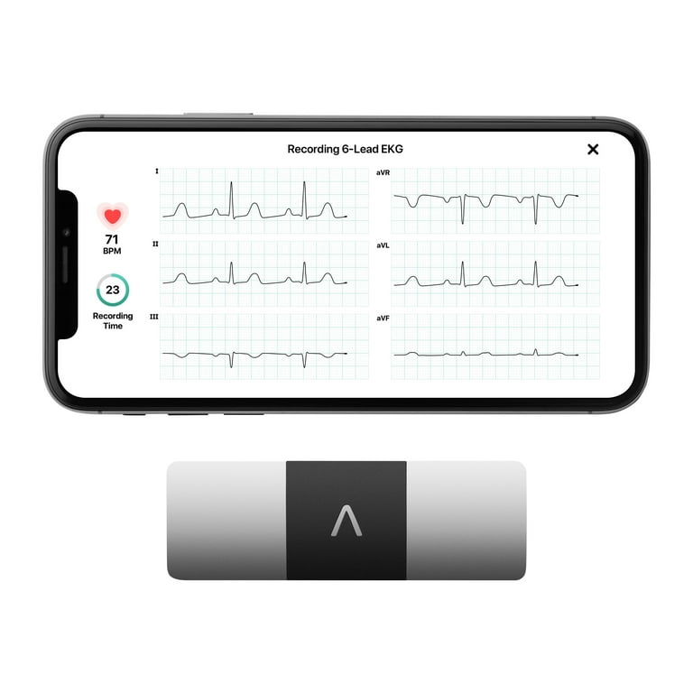 AliveCor KardiaMobile 6L Personal EKG Monitor Black AC019NUAA Best