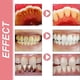 thumbnail image 3 of SP-8 Probiotic Toothpaste for Fresh Breath, Deep Cleaning, and Oral Care - Combat Bad Breath Effectively, 3 of 5