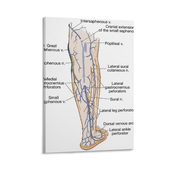 Varicose Veins Risk Signs And Symptoms Infographic Guide Medical Knowledge  Poster (3) Bedroom Office Room Printed Canvas Poster Wall Art Decoration Painting Aesthetic Poster Frame-styl