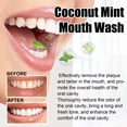 thumbnail image 3 of Coconut Oil Pulling, Brightening 100ml Teeth Oil Pulling  for Daily Care, 3 of 7