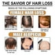 thumbnail image 2 of Fermented Rice Essence Conditioner Hair Follicle Rice Moisturizing Essence Hair Growth Liquid Hair Car, 2 of 5