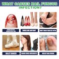 thumbnail image 2 of Traitement Épaississant pour Ongles Mains et Pieds Réparation Brillance Douce 75ml, 2 of 5