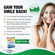 Temptooth #1 Seller Temporary Tooth Replacement Kit, Missing Tooth Kit, DIY Tooth Replacement, Affordable Dental Repair, Emergency Missing Tooth Fix