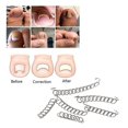 thumbnail image 3 of Kit de tratamiento de uñas encarnadas, kit de herramientas para uñas encarnadas: corrector de uñas encarnadas y aparatos ortopédicos para uñas de los pies, 3 of 5