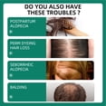 thumbnail image 4 of Suero Para El Crecimiento Del Cabello, Puntos De Reparación Líquidos Para La Regeneración Del Cabello Portátil Para El Hogar, 4 of 7