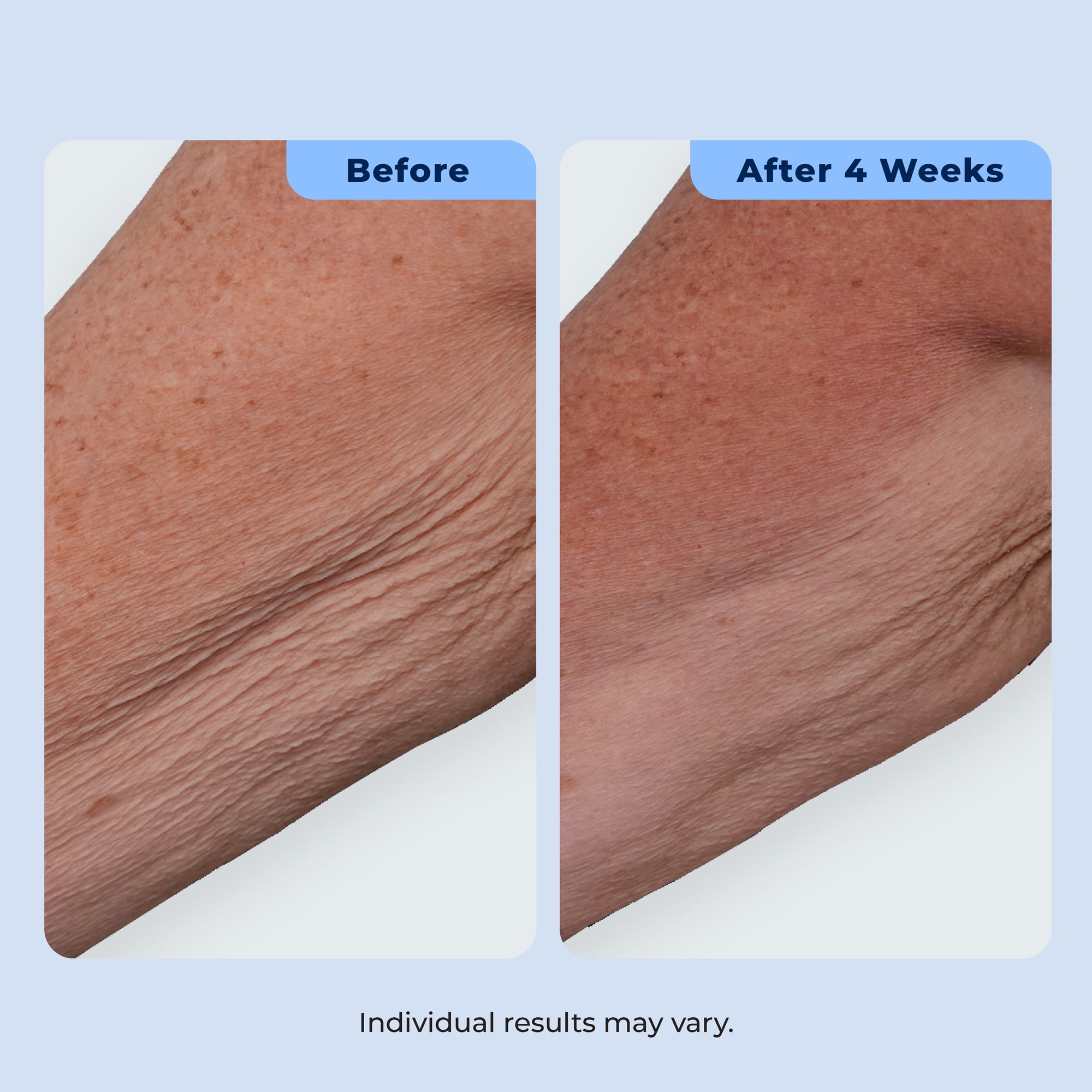 Plexaderm Dual Action Repair Cream for Neck, Chest & Arms – Firming Cream with Retinol & Bakuchiol for Crepey Skin, Fine Lines & Wrinkles