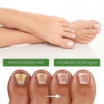 thumbnail image 4 of Nourishing Nail Strengthener for Healthy Growth and Renewal Suitable for All Nail Types, 4 of 5