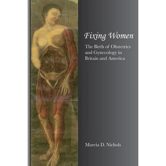Fixing Women (Paperback)