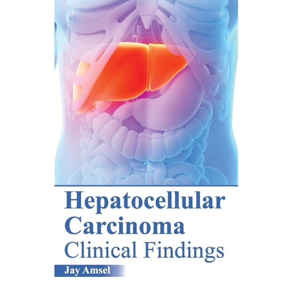 Hepatocellular Carcinoma: Clinical Findings, (Hardcover)
