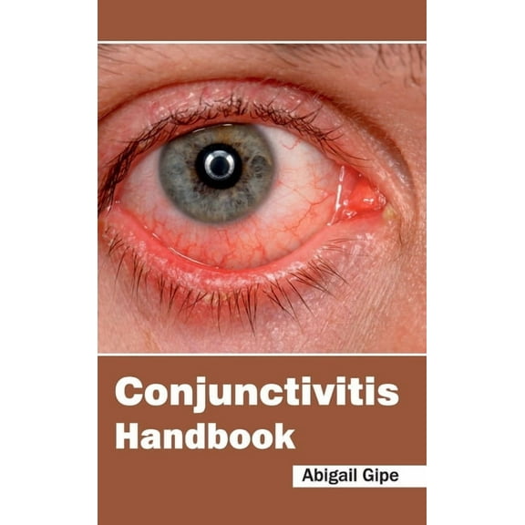 Conjunctivitis Handbook, (Hardcover)