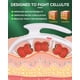 thumbnail image 4 of Eliminador de celulitis ONUEMP para piernas con herramienta de masaje de fascia, 4 of 7