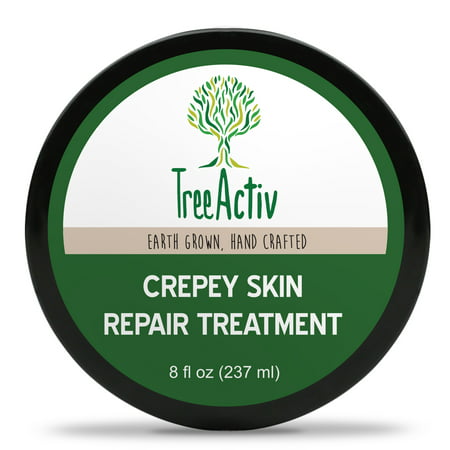 TreeActiv Crepey Skin Repair Treatment | Skin Lotion, Face, Neck, & Chest Firming Cream (Best Cream For Crepey Neck)