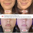 thumbnail image 2 of Set de ventosas faciales y herramienta facial Gua Sha Rena Chris, 2 of 6