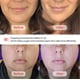 thumbnail image 2 of Set de ventosas faciales y herramienta facial Gua Sha Rena Chris, 2 of 6