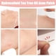 thumbnail image 2 of Parches para espinillas, puntos de parche para zit facial, pegatinas para cubrir imperfecciones, parche absorbente para acné, parche invisible para manchas hidrocoloides, impermeable y trans, 2 of 5