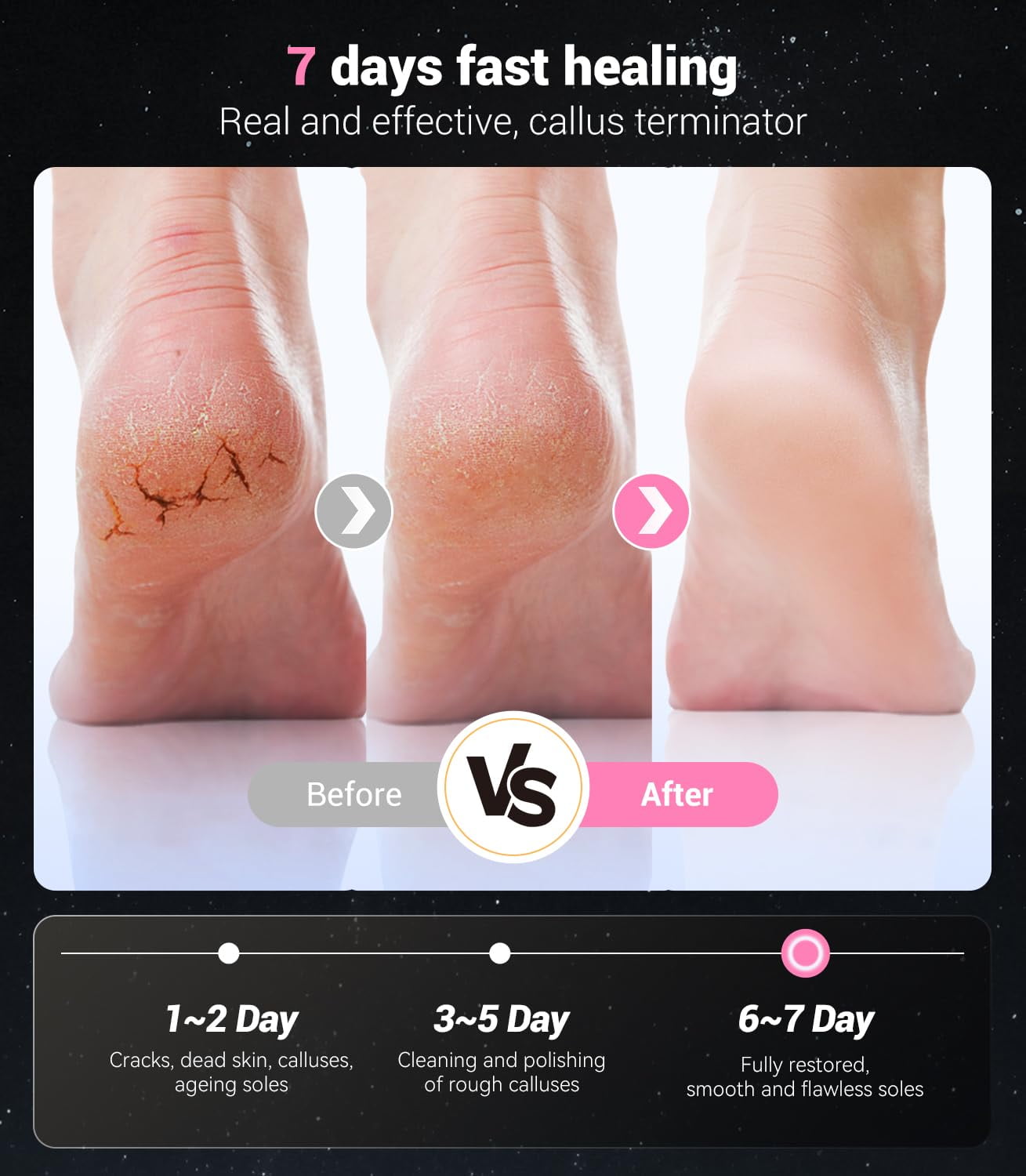 9-speed adjustable Professional Electric Callus Remover for Feet(Portable & Foldable), Removes of Calluses in 3 Mins, Eectric Foot Callus Remover Pedicure （rose gold18*10.8*3.8CM）