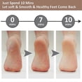 thumbnail image 4 of Electric Foot Callus Remover Rechargeable Food Grinder Electric Foot File Pedicure Kits Callus Razor for Dry Cracked Heels and Dead Skin, 4 of 5