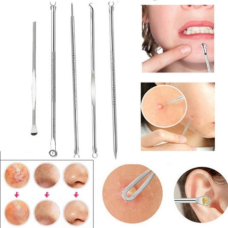 〖Follure〗5pcs Stainless Facial Acne Spot Pimple Remover Extractor Tool (The Best Acne Spot Remover)