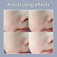 thumbnail image 2 of Suero facial retráctil de poros de ácido lactobiónico coreano ácido hialurónico hidratante esencia nutritiva reafirmante brillo crema para el cuidado de la piel Feliz Sencillez, 2 of 5
