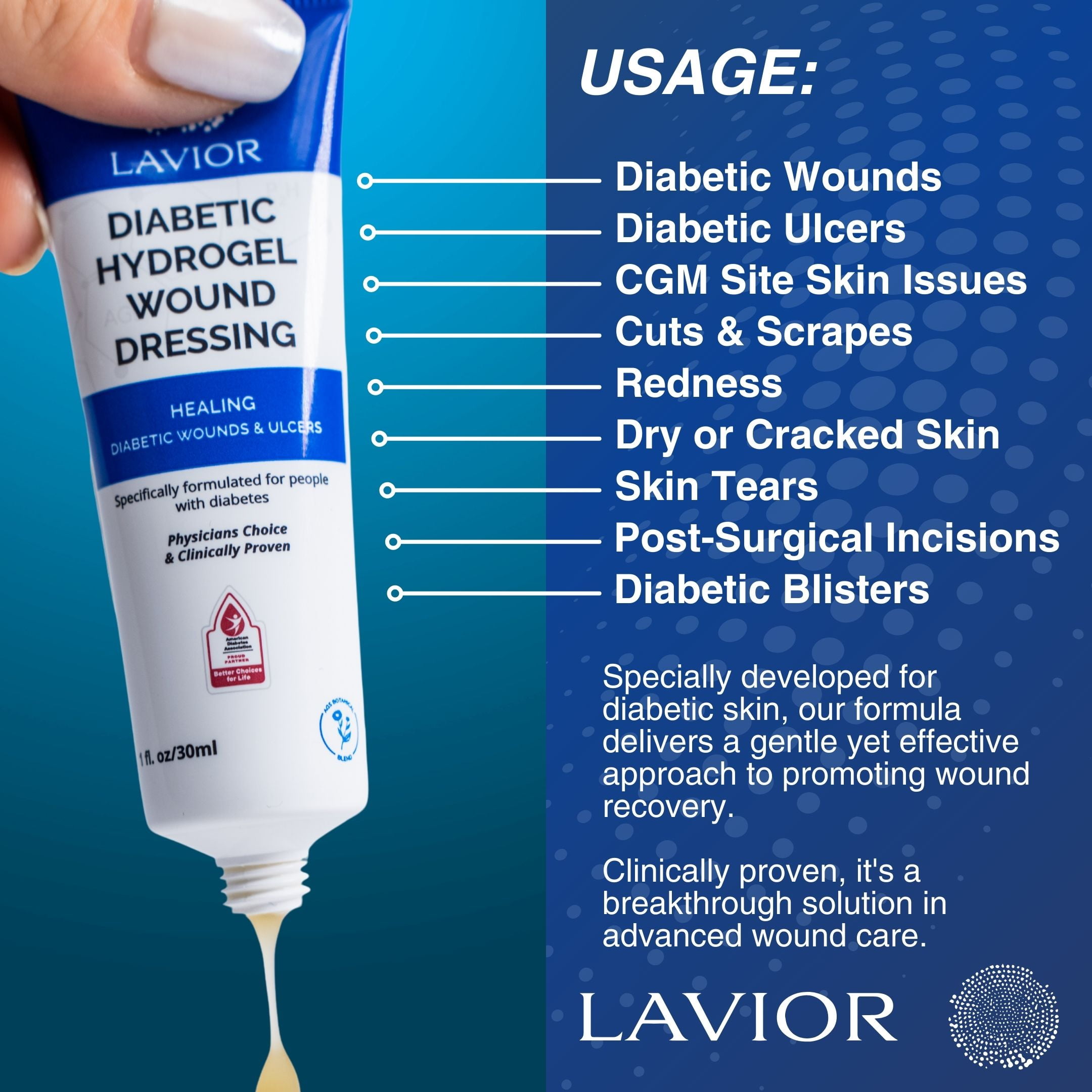 (2 pack) LAVIOR Diabetic Wound Gel 1oz – Natural Botanical Hydrogel for Cuts, Scrapes, Ulcers, CGM Site & Deep Wounds – Fast Healing – Inula Viscosa – ADA Endorsed, Podiatrist Tested, Vegan, Made in USA