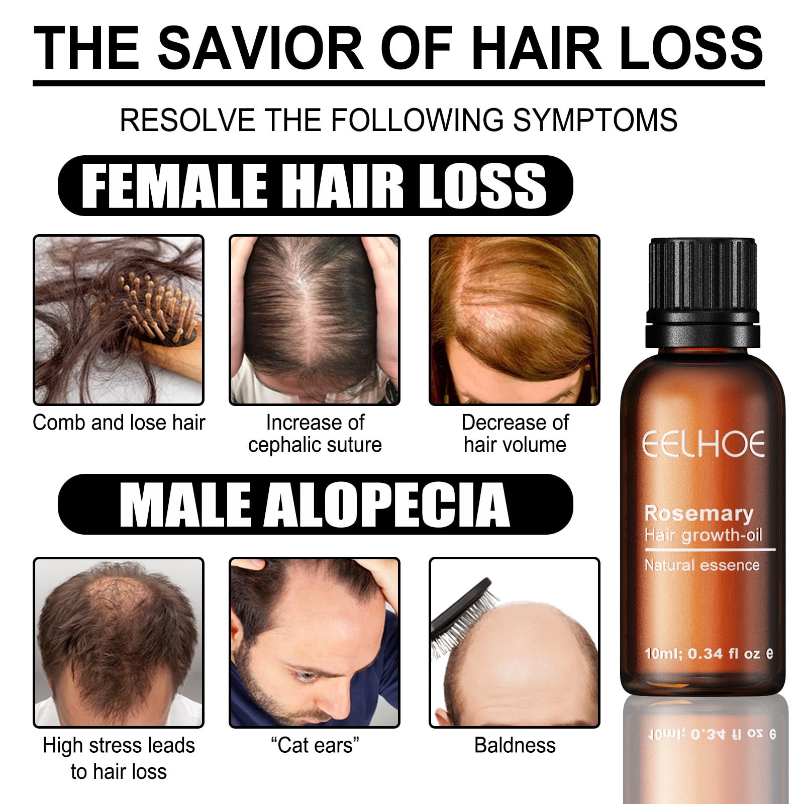 Buy Hair Growth Drops Rosemary Oil, Peptides & Minoxidil Hair Loss