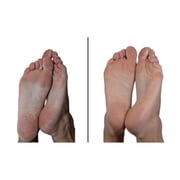 Emjoi Micro-Pedi Callus Remover with Bonus Replacement Rollers - White