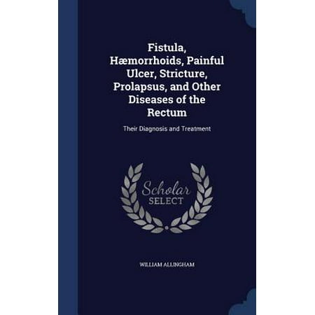 Fistula, Haemorrhoids, Painful Ulcer, Stricture, Prolapsus, and Other Diseases of the Rectum : Their Diagnosis and (Best Haemorrhoid Treatment Uk)