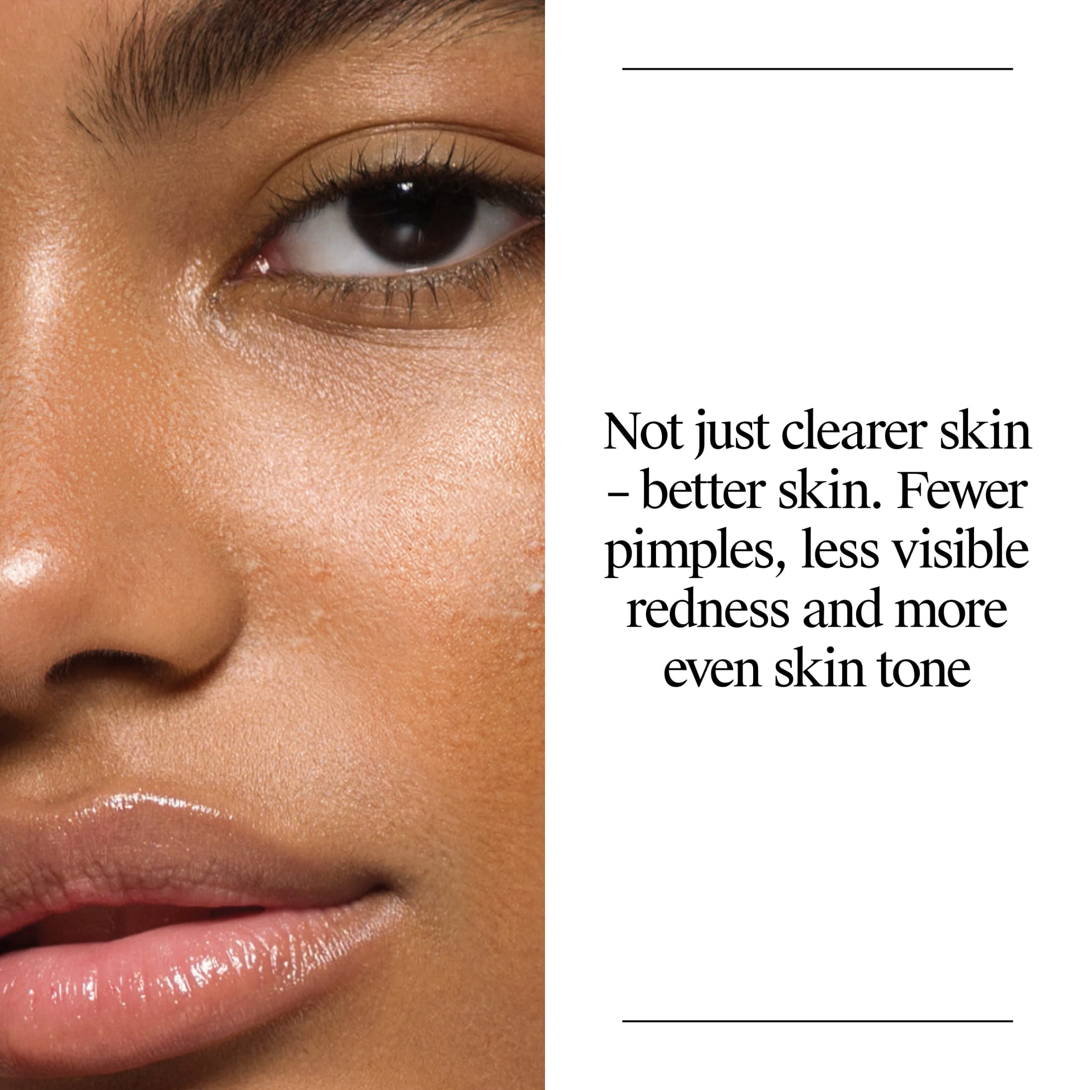 Neutrogena Oil-Free Acne Face Wash, Salicylic Acid Facial Cleanser & Acne Treatment, 16 fl oz