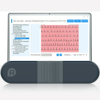 AliveCor KardiaMobile Personal EKG Monitor Black • Price »
