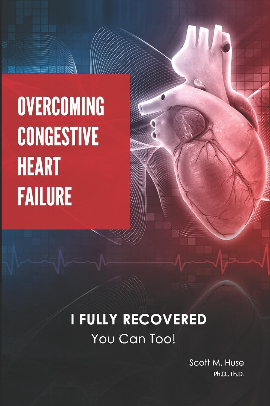 Congestive Heart Failure I Fully Recovered